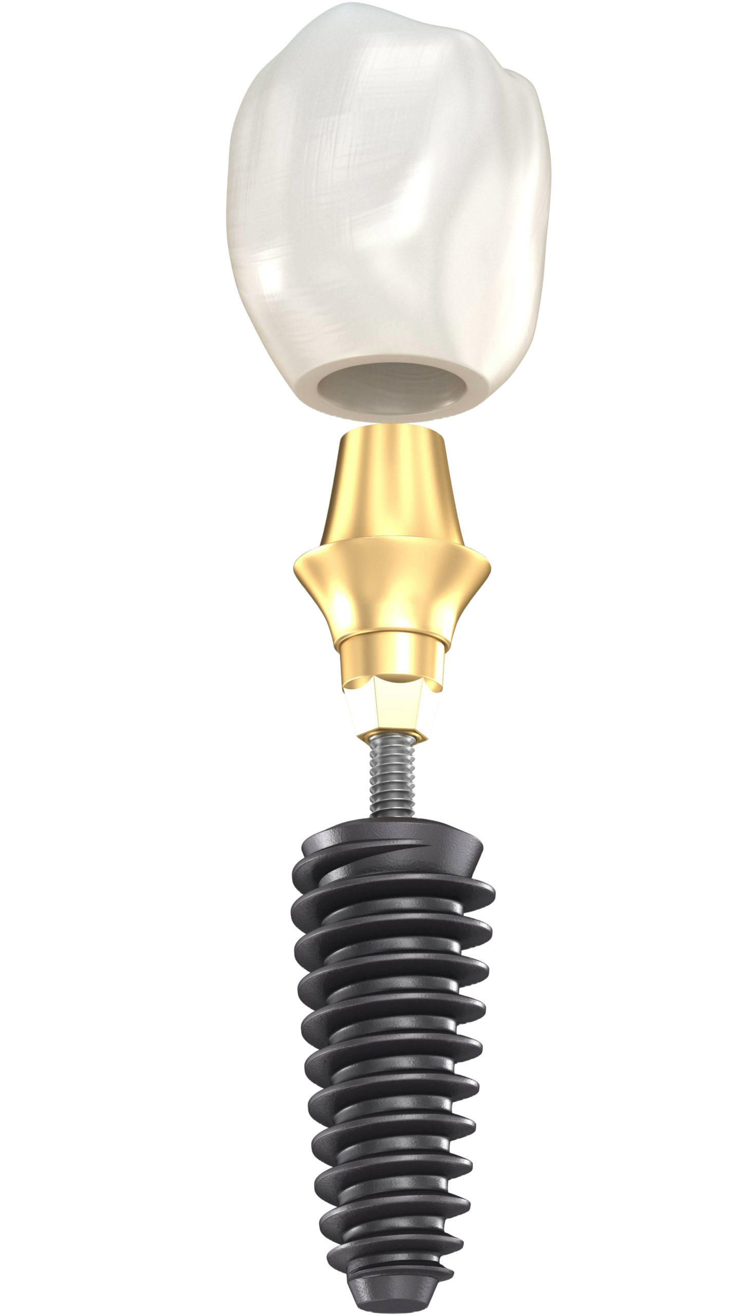 Dental implant components: crown, abutment and implant